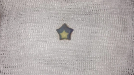 Во Владимире 2-летний ребенок проглотил пластиковую звездочку