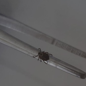 С людей во Владимирской области сняли 5 зараженных вирусами клещей