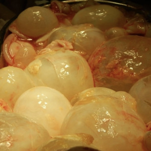 Во Владимирской области у ребенка в печени обнаружили паразитов