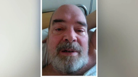 Во Владимирской области пропал мужчина с бородой и усами