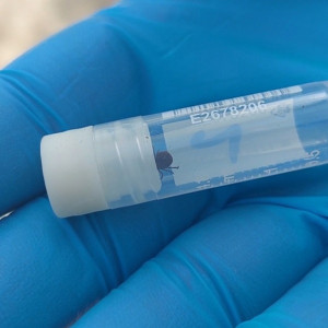 Во Владимирской области клещей сняли с 12 детей