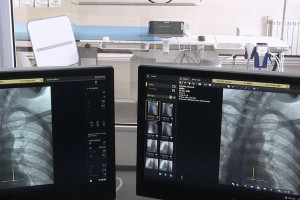 В Муромской больнице появился новый ангиограф