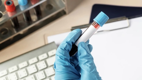 Во Владимирской области у 91 жителя подтвердился ковид