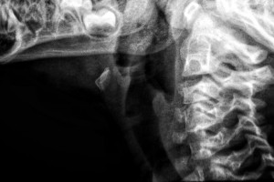 Во Владимире врачи ОДКБ диагностировали у новорожденного редкую патологию 