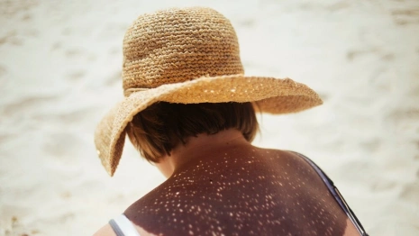 Изнуряющий зной накрывает Владимирскую область. Как избежать солнечного удара