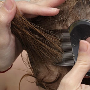 Во Владимирской области у 126 человек нашли вши