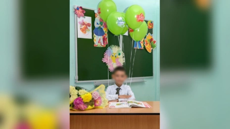 В деревне под Юрьев-Польским собака укусила 10-летнего мальчика между ног