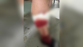 В Коврове собаки напали на 4 взрослых и ребенка