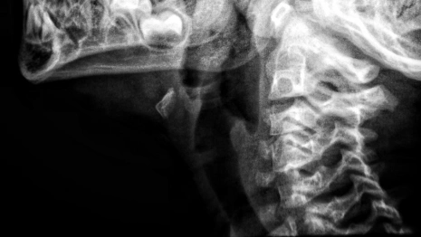 Во Владимире врачи ОДКБ диагностировали у новорожденного редкую патологию 