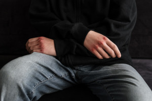 «Над ним уже издевались в классе». Что известно о избитом школьнике из Юрьев-Польского