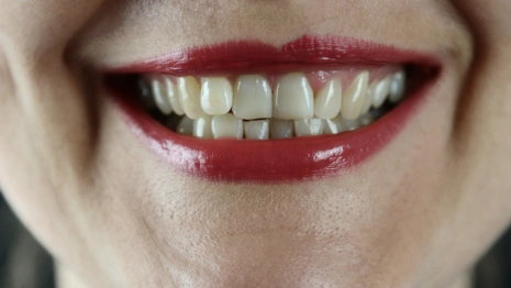 Во Владимирской области девушку оштрафовали за укус полицейского