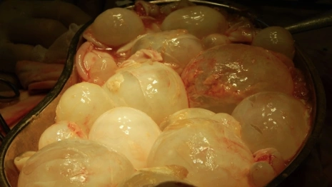 Во Владимирской области у ребенка в печени обнаружили паразитов