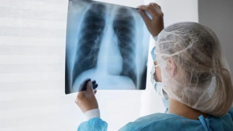 Во Владимирской области «читать» рентгены в больницах будет искусственный интеллект