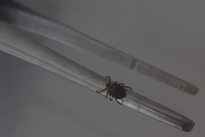 Во Владимирской области с людей сняли 11 зараженных вирусами клещей