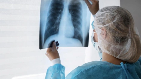 Во Владимирской области пациент с заразной формой туберкулеза свободно разгуливал по улицам