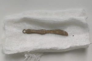 Владимирские врачи спасли 4-летнего ребенка с игрушечным кинжалом в кишечнике