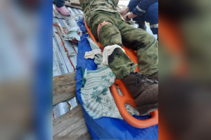 Житель Коврова разрезал ногу болгаркой во время ремонта крыши