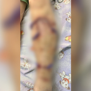 Жители Киржача испугались из-за нападающих на людей и животных собак