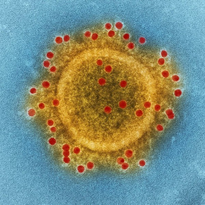 Во Владимирской области заболеваемость ковидом снизилась до 175 случаев