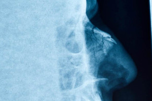 20-летний владимирец сломал полицейскому нос