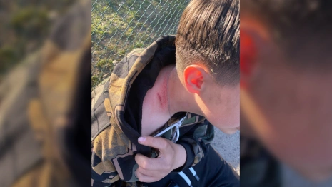 Во Владимирской области избиение подростка отцом с сыном обернулось уголовным делом