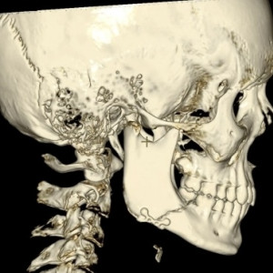 Владимирские врачи спасли подростка после избиения в новогодние каникулы