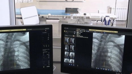 В Муромской больнице появился новый ангиограф