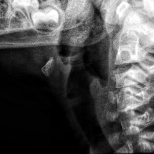 Во Владимире врачи ОДКБ диагностировали у новорожденного редкую патологию 