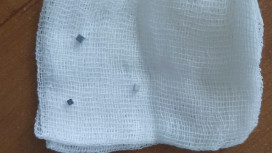 Владимирские врачи спасли проглотившего магниты годовалого малыша