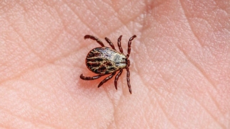 Во Владимирской области клещи присосались к 45 взрослым и 9 детям