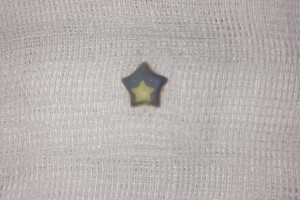 Во Владимире 2-летний ребенок проглотил пластиковую звездочку