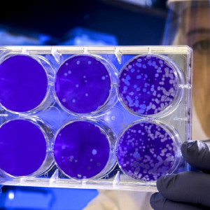 Владимирские санврачи назвали города с максимальным приростом COVID-19