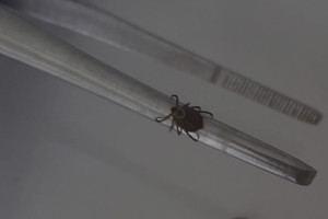 С жителей Владимирской области сняли 13 зараженных болезнью Лайма клещей