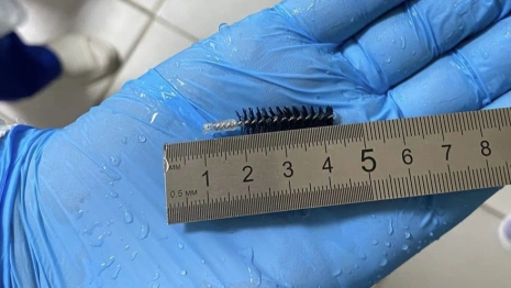 Владимирские врачи спасли поглотившего кончик ершика мужчину