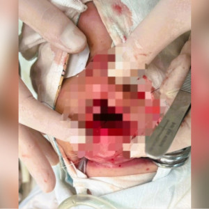 Владимирские врачи спасли ребенка с серьезной травмой лица