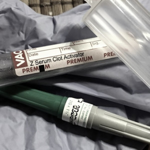 Суточная смертность от ковида во Владимирской области стала рекордной с 31 мая