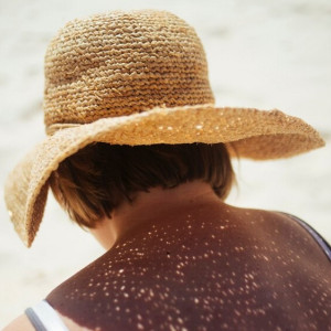 Изнуряющий зной накрывает Владимирскую область. Как избежать солнечного удара