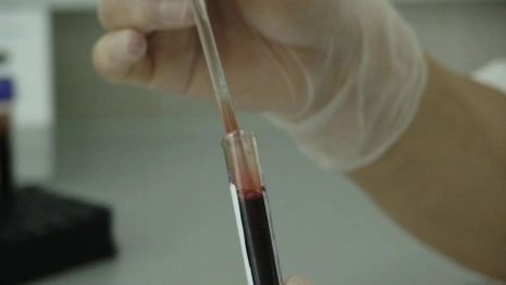 Онкобольные стали в два раза чаще лечиться во Владимирской области