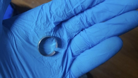 В Коврове спасатели вызволили застрявший в кольце палец девушки