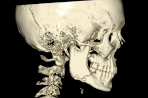 Владимирские врачи спасли подростка после избиения в новогодние каникулы