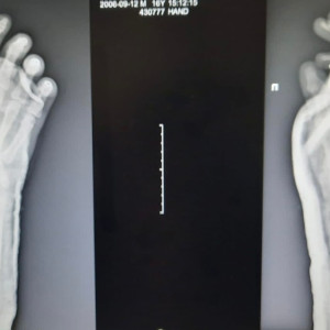 В нижегородской клинике рассказали о подростке из Коврова, отрубившем себе кисть