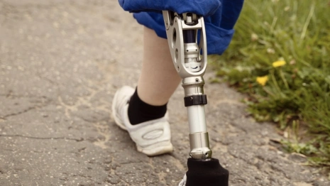 Прокуратура пресекла покупку ржавых протезов для инвалидов во Владимирской области