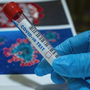 7 жителей Владимирской области умерли от ковида за сутки