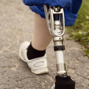 Прокуратура пресекла покупку ржавых протезов для инвалидов во Владимирской области