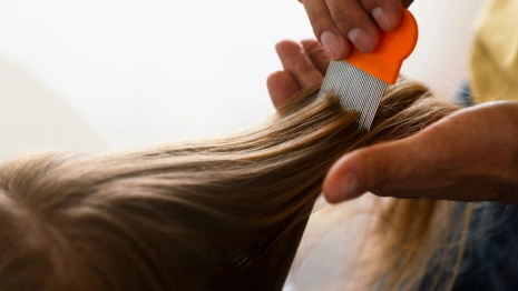 Гайд «День во Владимире». Как уберечь ребенка от педикулеза