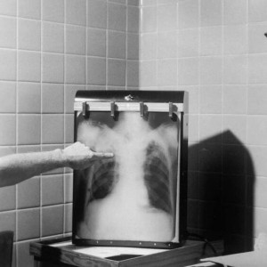 Во Владимирской области двое больных туберкулезом избегали лечения