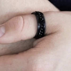 Жительница Коврова вызвала спасателей из-за застрявшего в кольце пальца