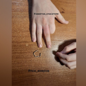 В Коврове у 9-летнего школьника палец застрял в погнутом кольце