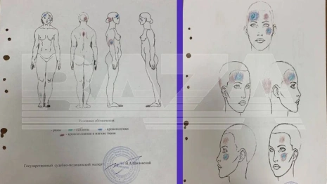 Суд отправил на пересмотр дело о загадочной смерти женщины во Владимирской области