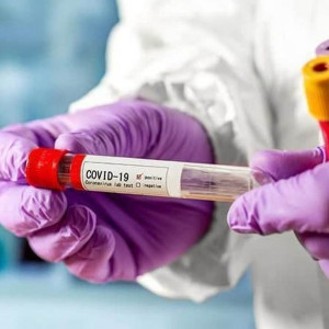 Прирост заболевших ковидом владимирцев впервые за две недели пошел на спад